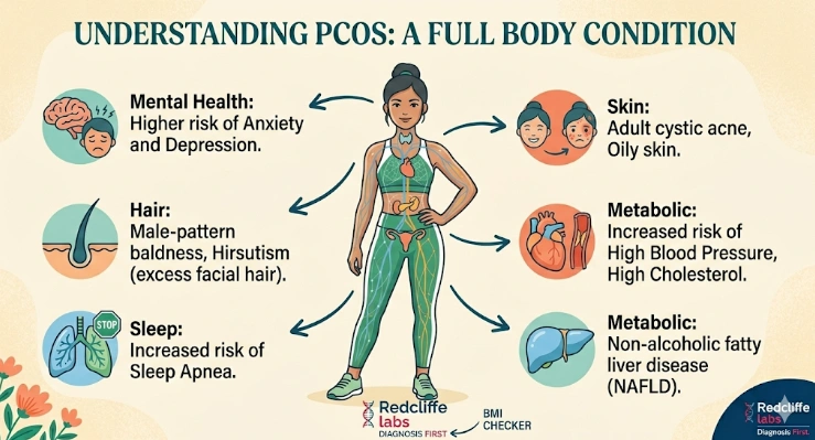 PCOS