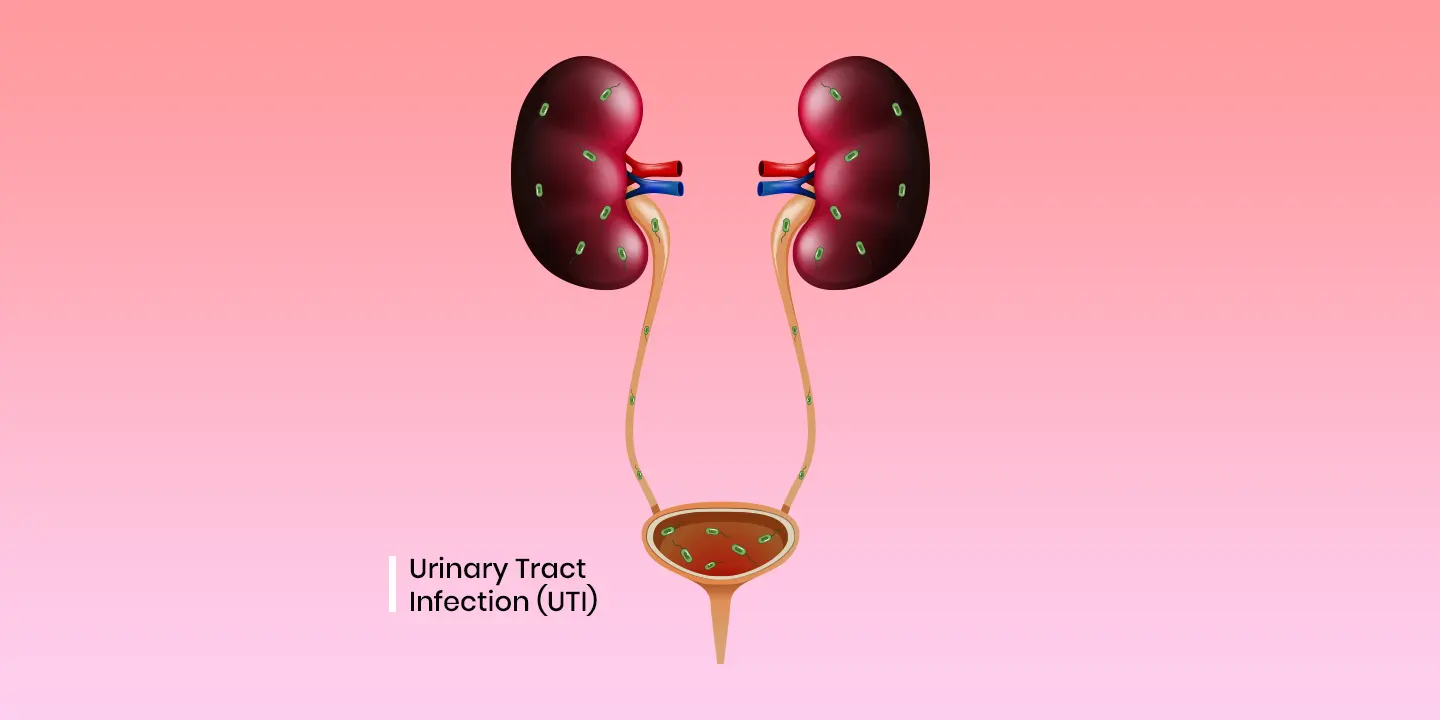 Urinary Tract Infection (UTI): Symptoms, Causes, and Treatment In India