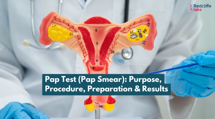 Pap Test (Pap Smear): Purpose, Procedure, Preparation & Results