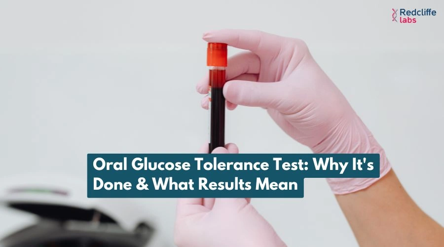 Oral Glucose Tolerance Test: Why It's Done & What Results Mean